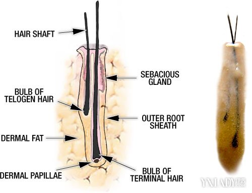 什么叫头发毛囊坏死教你怎么判断病根_什么叫头发毛囊坏死_伊秀美容网 