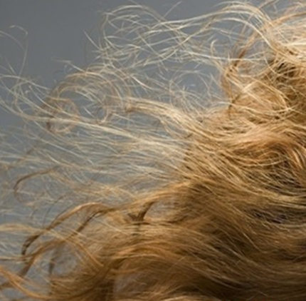 【图】阴虱在头发上怎么办呢? 盘点你需了解的