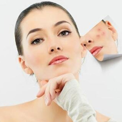 【图】额头上老长痘痘怎么办呢 5个食疗方法轻