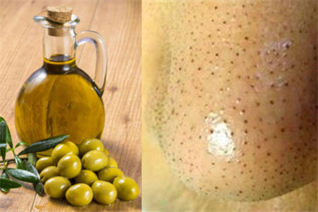 【图】草莓鼻怎么自己处理  这几招让你远离黑头