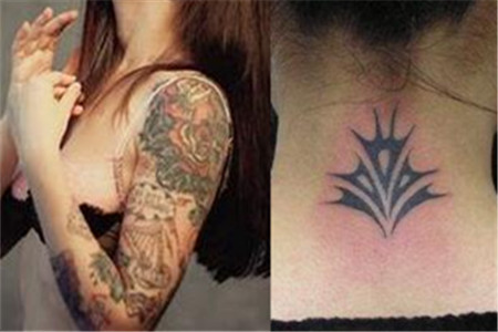 【图】纹身去除方法 新科技的激光治疗_纹身去