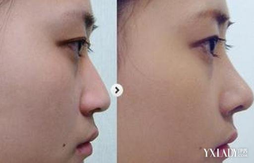 BY2���û��ٱ���