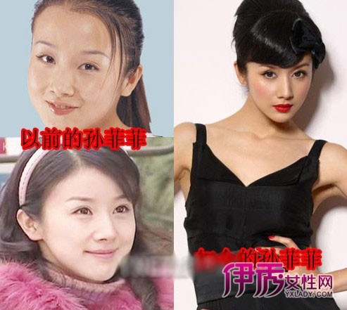女星整容最全惊悚照 杨幂竟成曾轶可