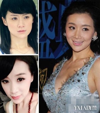 Ҧܷ������ǰ����Ƭ